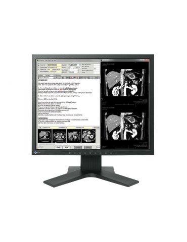 EIZO RadiForce MX194 48,3 cm (19") 1280 x 1024 Pixel LCD Negru Eizo - 2