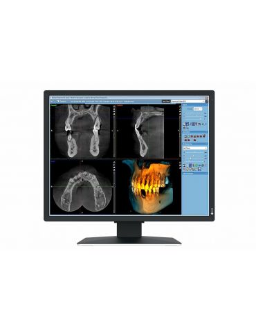 EIZO RadiForce MX217-SB monitoare LCD 53,3 cm (21") 1200 x 1600 Pixel UXGA Negru